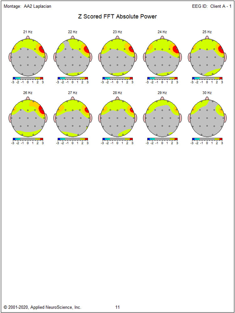 Z-scored FFT absolute power Laplacian montage continued